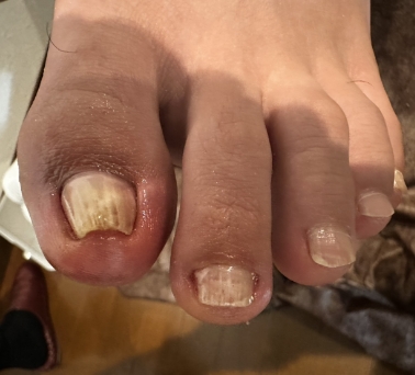 After