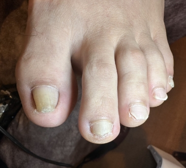 Before