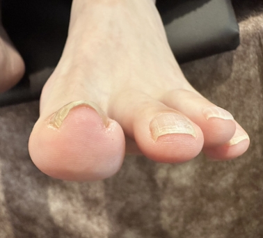 Before